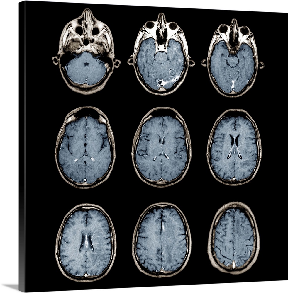 Normal brain, MRI scans Art, Canvas Prints, Framed Wall Peels | Great Big