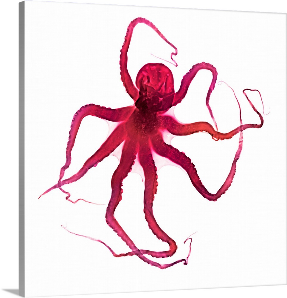Octopus, coloured X-ray.