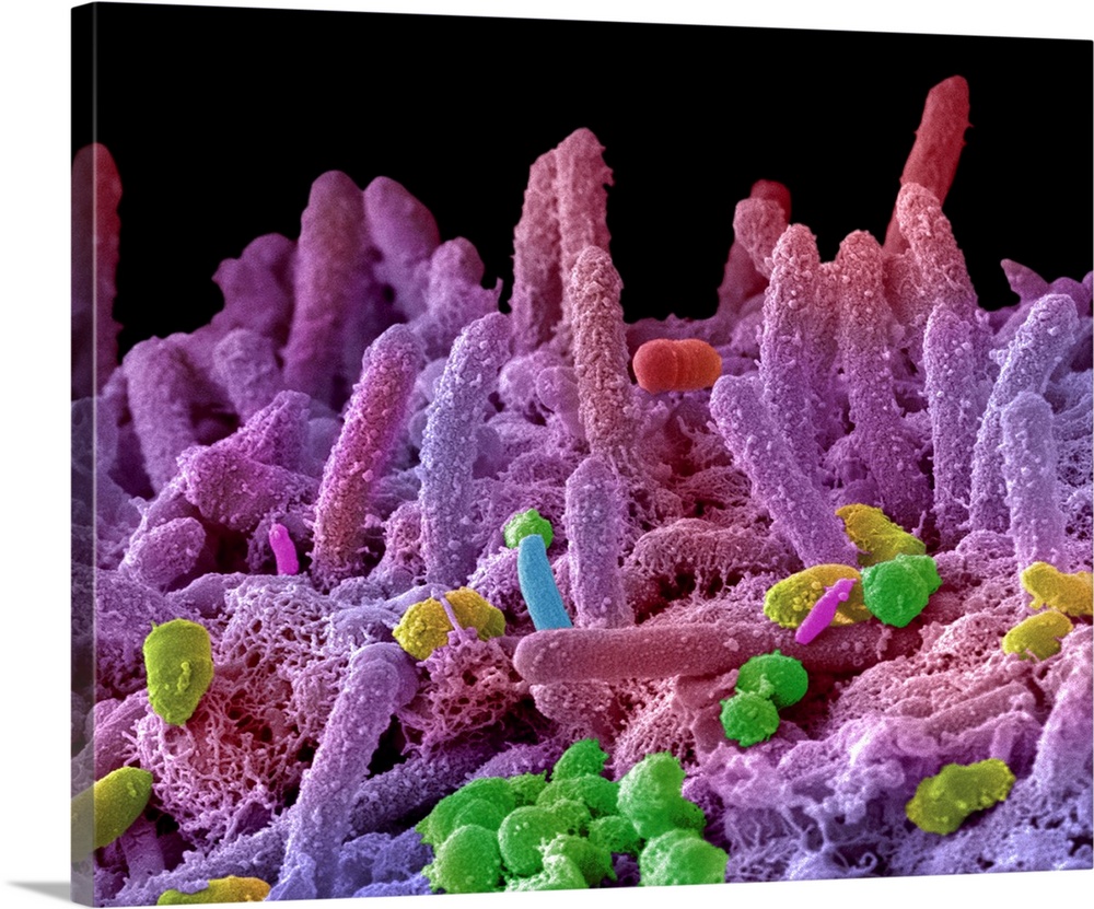 Oral bacteria. Coloured scanning electron micrograph (SEM) of mixed oral bacteria. The mouth contains a large number of ba...