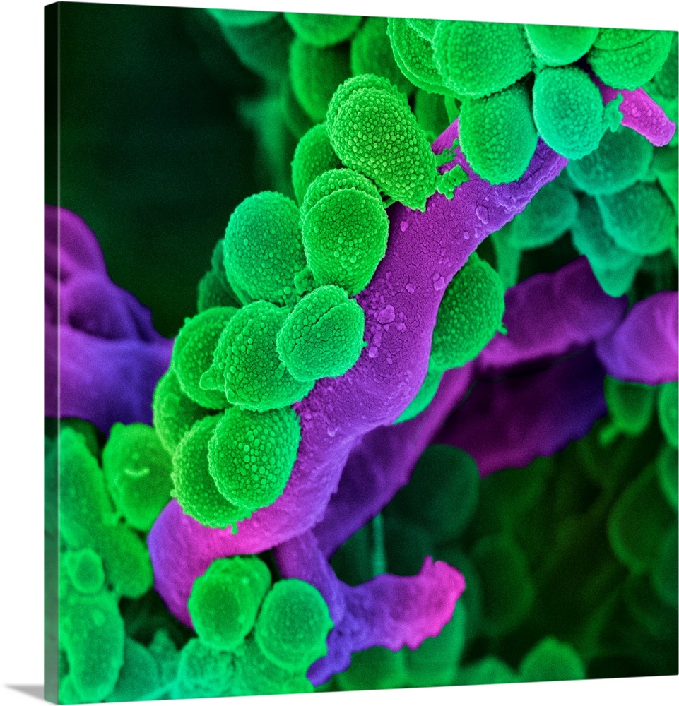 Oral Streptococcus bacteria. Coloured scanning electron micrograph (SEM) of chains of Streptococcus sp. bacteria from the ...