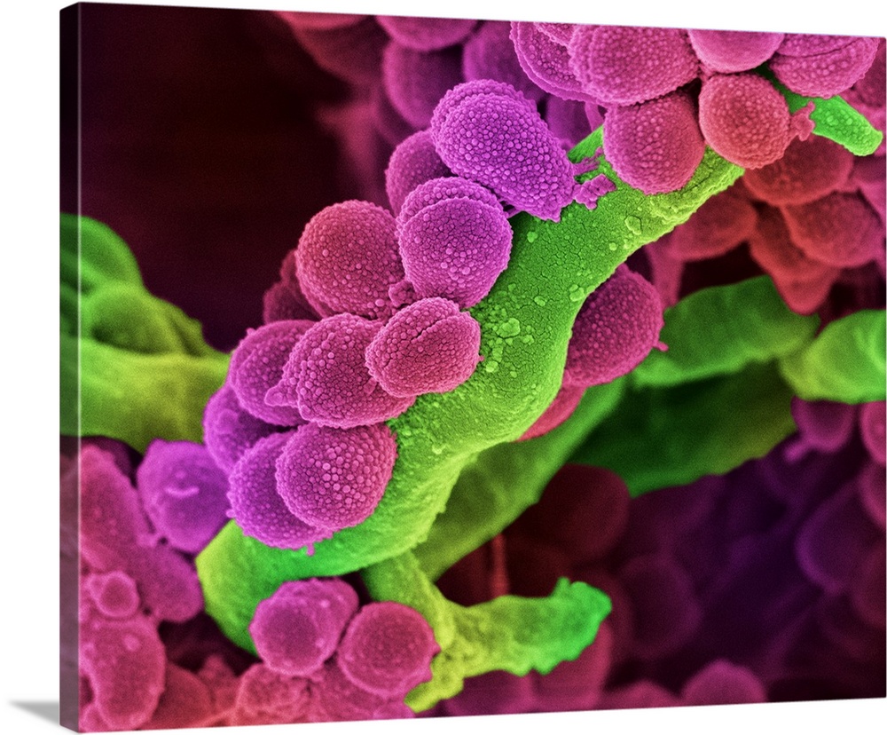 Oral Streptococcus bacteria. Coloured scanning electron micrograph (SEM) of chains of Streptococcus sp. bacteria from the ...