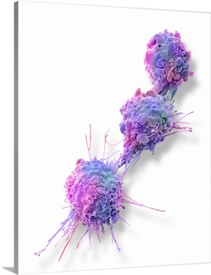 Ovarian Cancer Cells, SEM