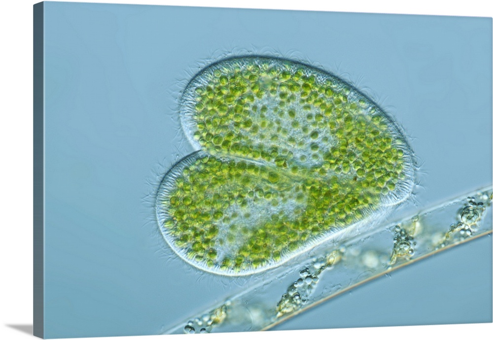 Paramecium bursaria protozoa, light micrograph. These ciliate protozoa inhabit freshwater, where they feed mainly on bacte...