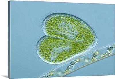 Paramecium protozoa, light micrograph