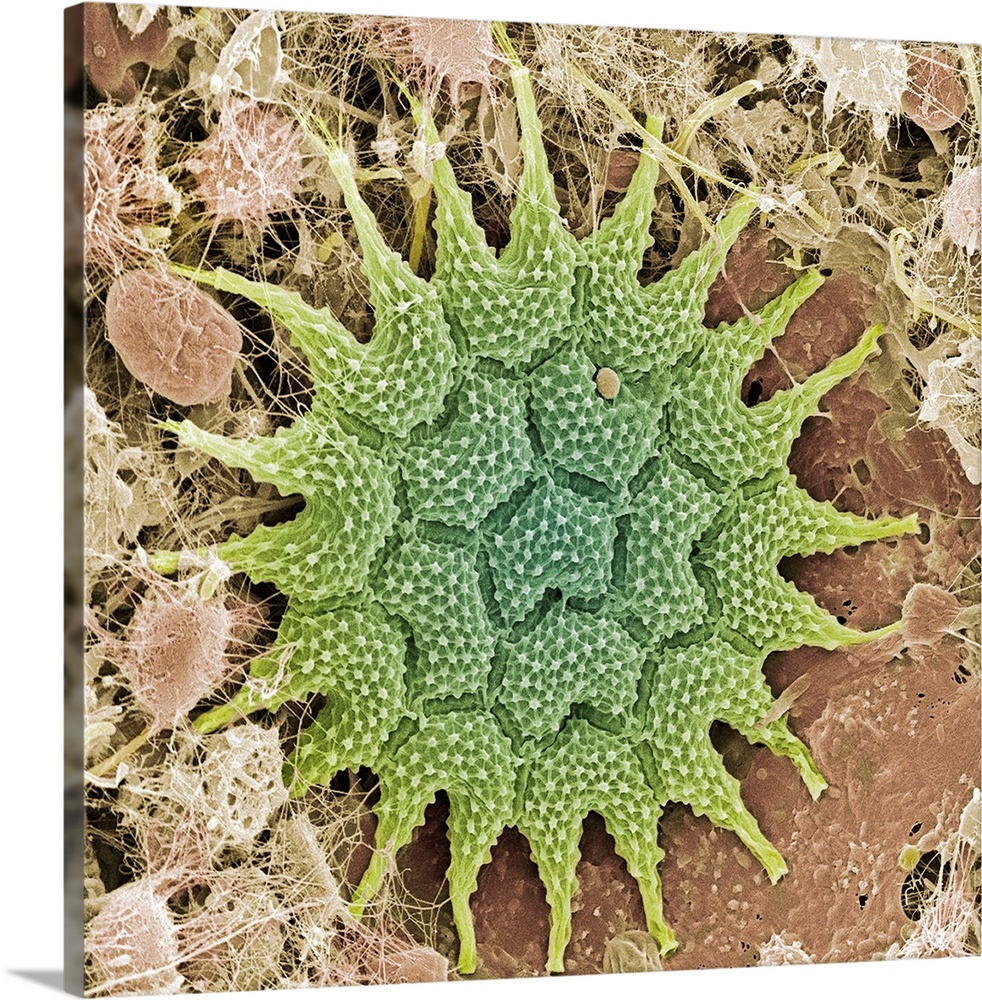 Pediastrum alga. Coloured scanning electron micrograph (SEM) of the disc-like colony of cells formed by the green alga, Pe...