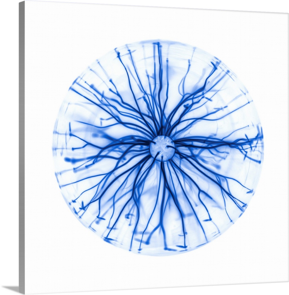 Light streamers inside a plasma globe, negative image. A plasma globe is a glass sphere filled with a gas at low pressure....