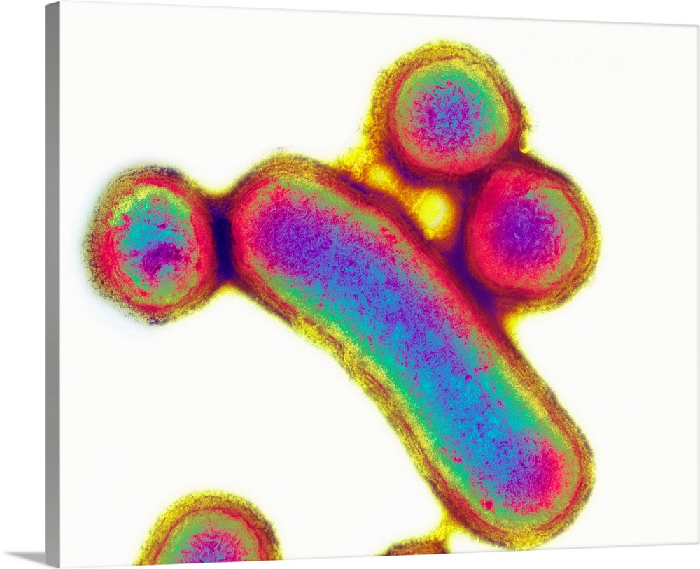Porphyromonas bacteria. Coloured transmission electron micrograph (TEM) of Porphyromonas gingivalis bacteria (formerly nam...