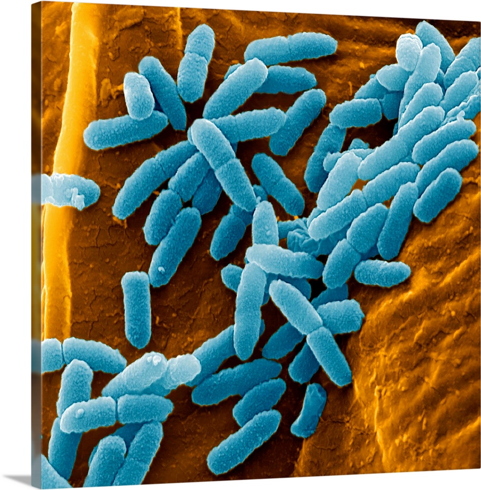 Pseudomonas aeruginosa bacteria, coloured scanning electron micrograph (SEM). These Gram-negative rod-shaped bacteria are ...