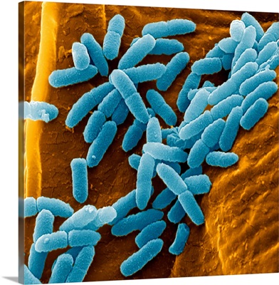 Pseudomonas aeruginosa bacteria, SEM