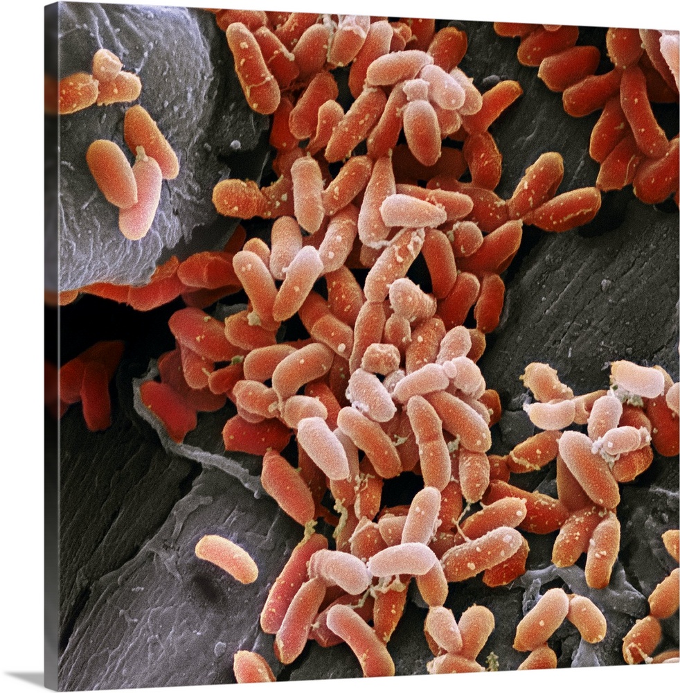 Pseudomonas aeruginosa bacteria, coloured scanning electron micrograph (SEM). These Gram-negative rod-shaped bacteria are ...