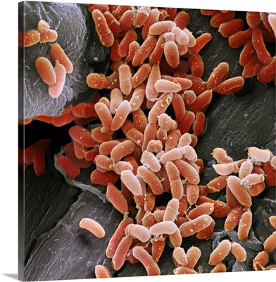 Pseudomonas aeruginosa bacteria, SEM