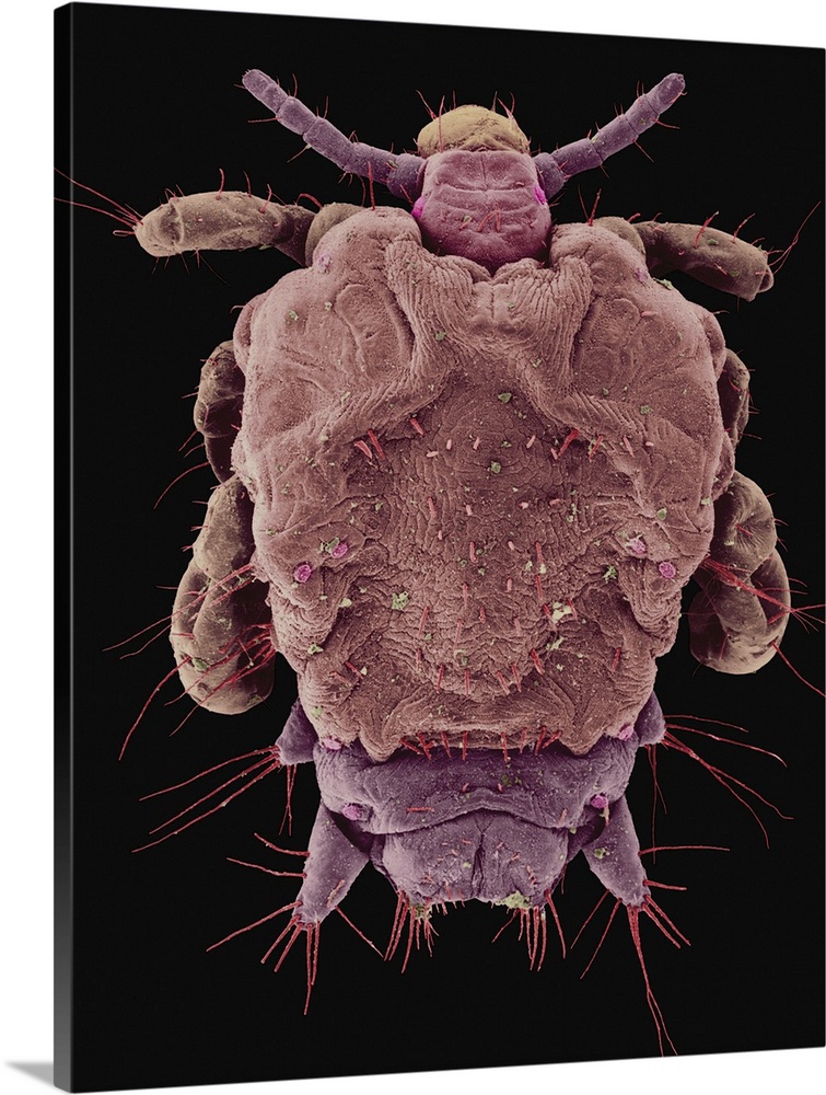Coloured scanning electron micrograph (SEM) of Pubic louse -Pthirus pubis. The pubic louse (also called the crab louse) ha...