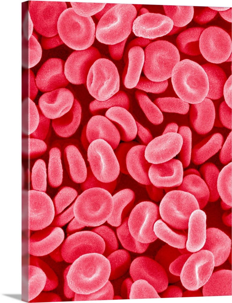 Red blood cells. Coloured scanning electron micrograph (SEM) of red blood cells (erythrocytes). Red blood cells are biconc...