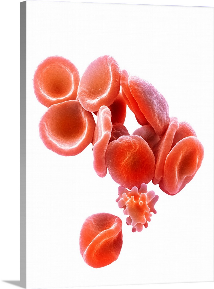 Red blood cells. Coloured scanning electron micrograph (SEM) of red blood cells (RBCs, erythrocytes). A single crenated re...