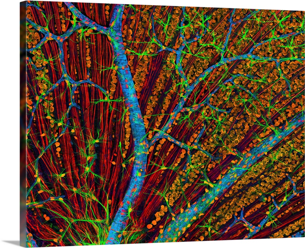 Retina blood vessels and nerve cells. Confocal light micrograph of the retina, the light-sensitive membrane that lines the...