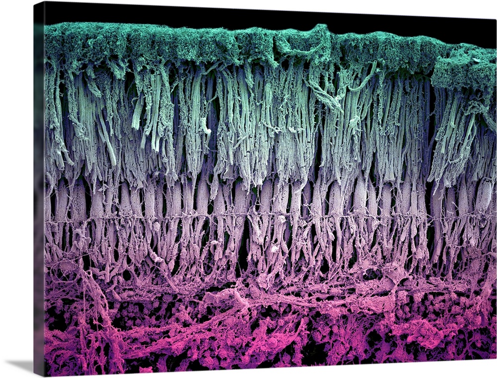 Retina layers, coloured scanning electron micrograph (SEM). The retina of the human eye is found on the inside of the eyeb...