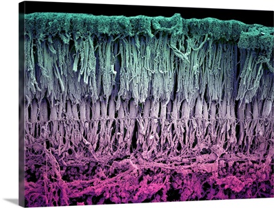 Retina Layers, SEM