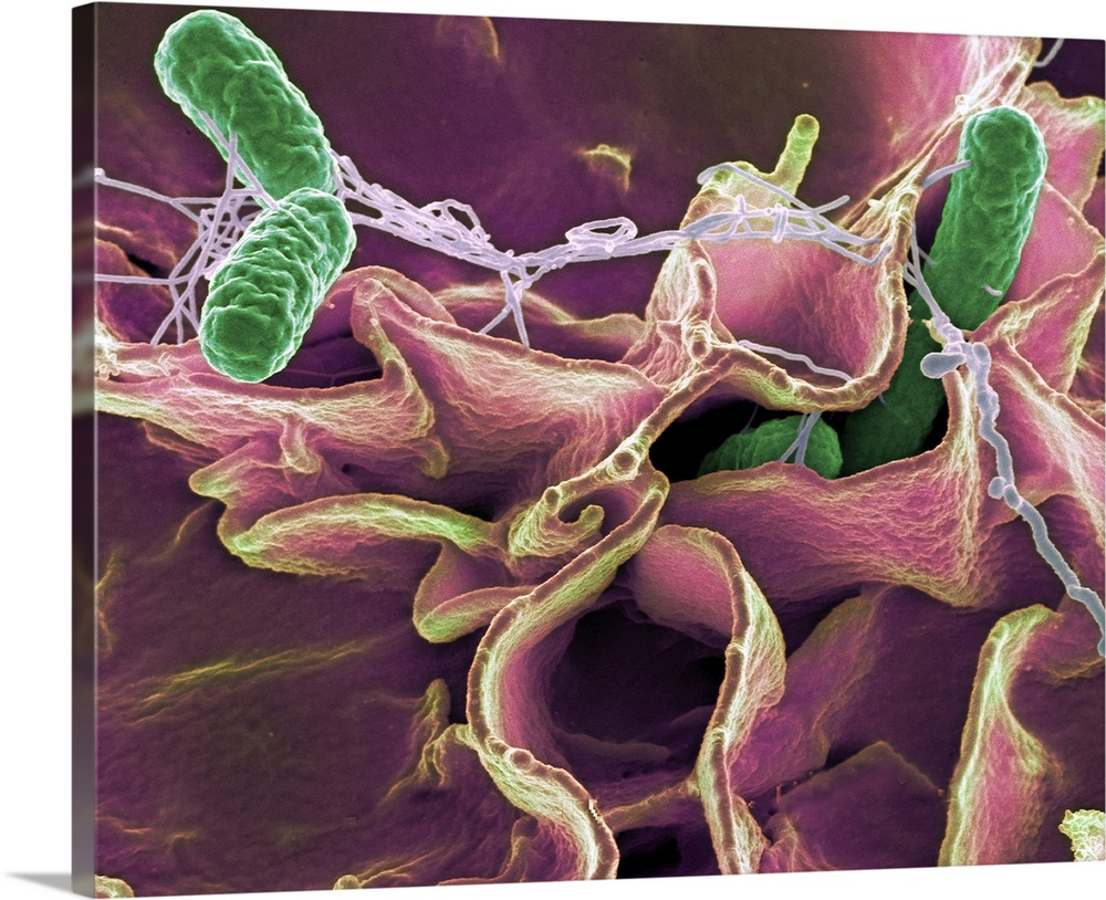 Salmonella bacteria (green), coloured scanning electron micrograph (SEM). Salmonella bacteria can cause food poisoning whe...