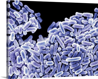 Salmonella bacteria, SEM