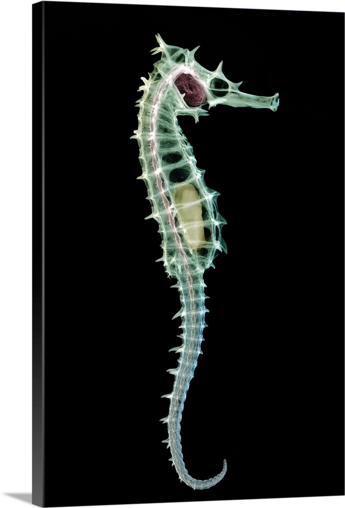 Seahorse skeleton. Coloured x-ray of a seahorse (Hippocampus sp.). Seahorse populations are under threat due to the fishin...