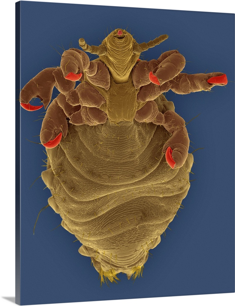 Coloured scanning electron micrograph (SEM) of Short-nosed cattle louse (Haematopinus eurysternus). It is a louse found ar...
