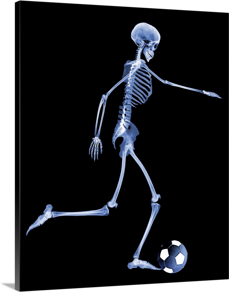 Skeleton playing football. Computer enhanced X- ray of a skeleton kicking a football.