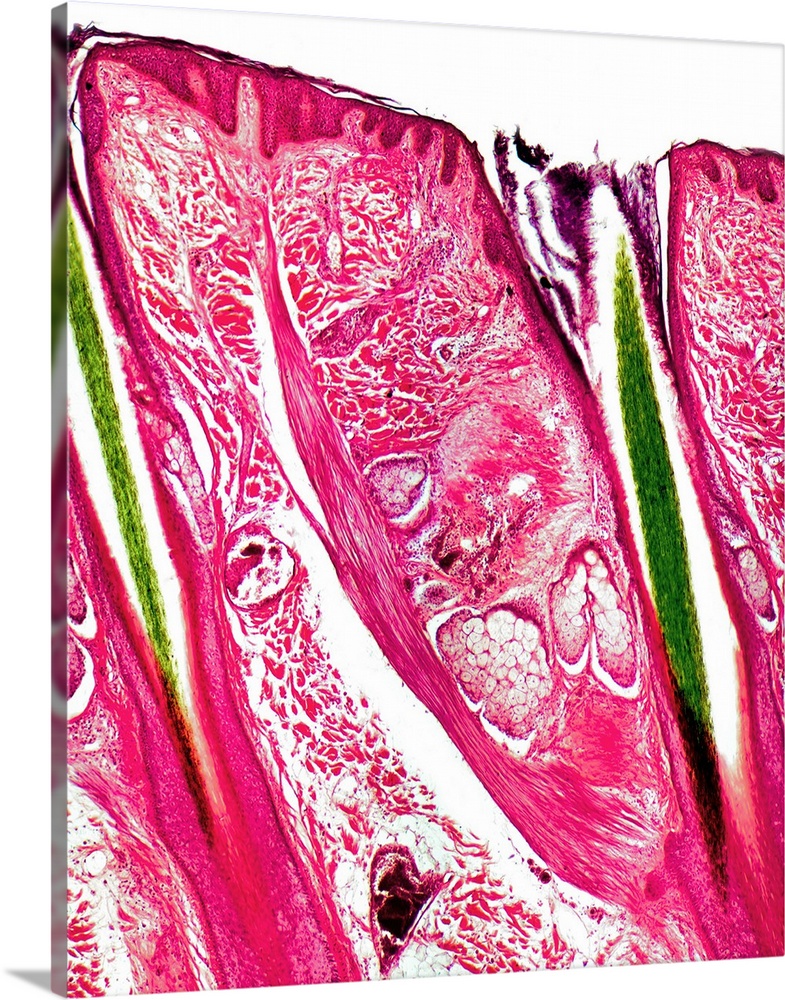 Skin section. Semi-polarised light micrograph of a vertical section through human skin. The outer epidermis is the thin la...