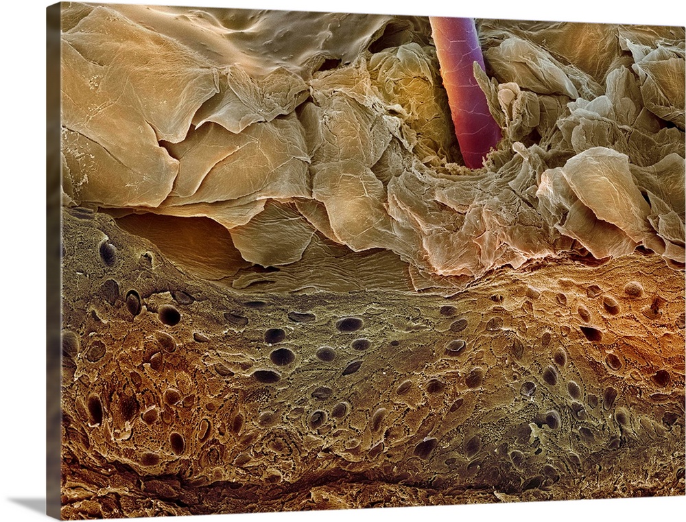 Skin section. Coloured scanning electron micrograph (SEM) of a section through human skin. A hair (red) is protruding thro...