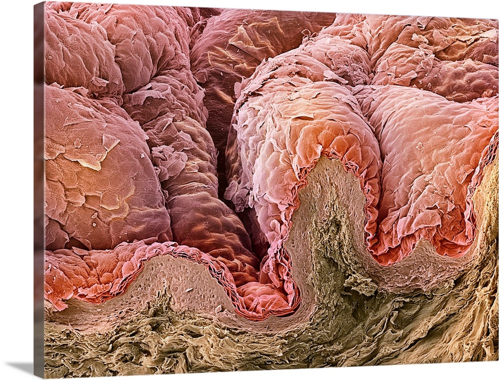 Skin. Coloured scanning electron micrograph (SEM) of a section through healthy skin from the breast. The top layer is the ...