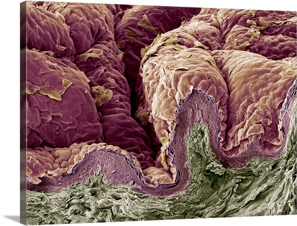 Skin tissue. Coloured scanning electron micrograph (SEM) of a freeze-fracture through human skin tissue. The fracture plan...
