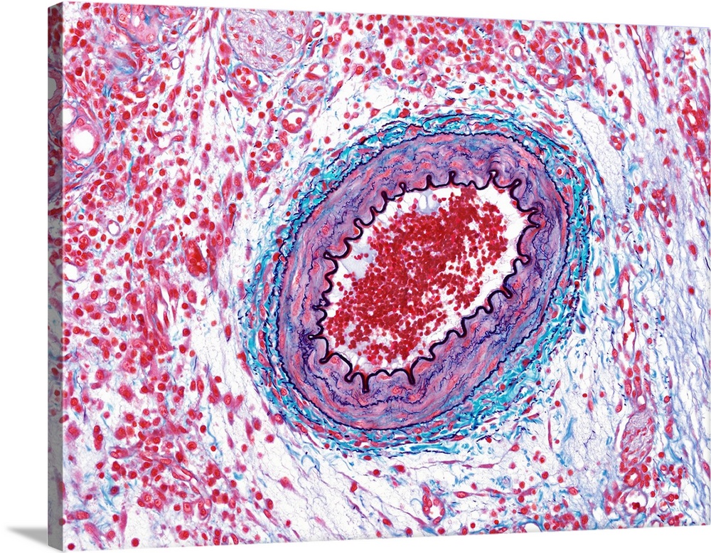 Small muscular artery. Light micrograph of a cross-section through a small muscular artery and surrounding tissue. These s...