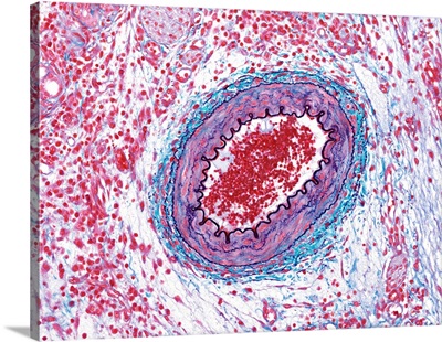 Small muscular artery, light micrograph