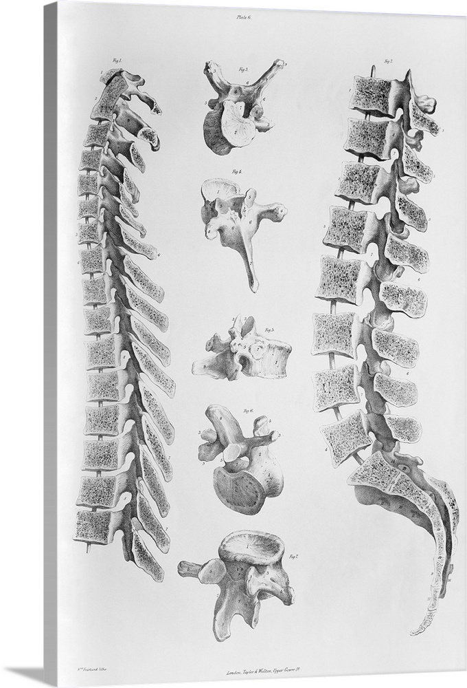 Spine anatomy. Historical anatomical artwork of a section through the spine (backbone) seen from the side (rear of spine a...