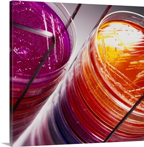 Stack of petri dishes with bacterial cultures image thumbnail