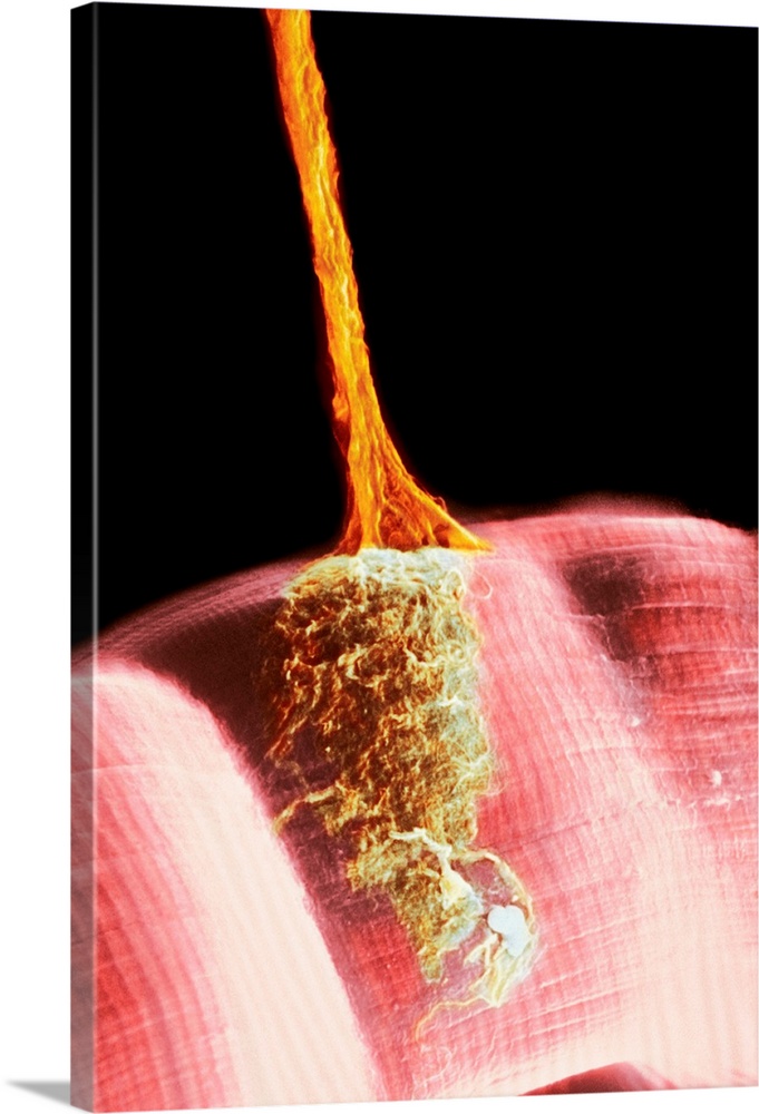 Synapse. Coloured scanning electron micrograph (SEM) of a neuromuscular junction showing a motor neurone (orange) terminat...