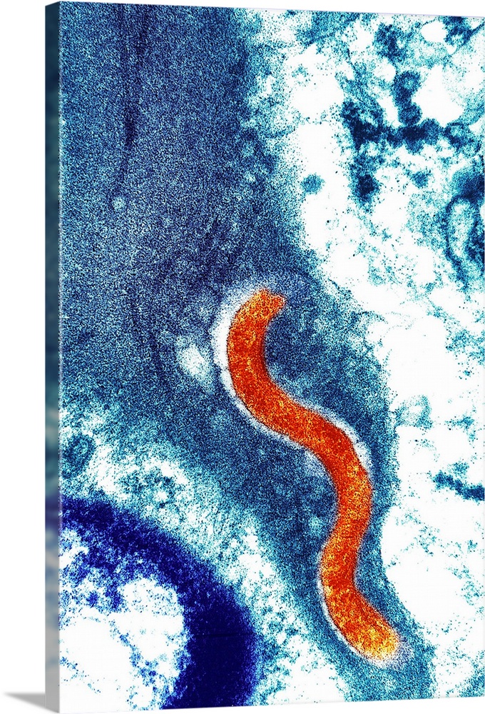 Syphilis bacterium (Treponema pallidum). Coloured transmission electron micrograph (TEM) showing a Treponema pallidum bact...
