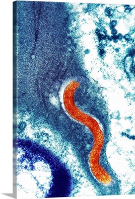 Syphilis bacterium (Treponema pallidum)