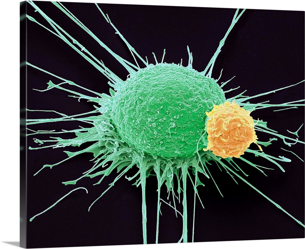 T lymphocyte and prostate cancer cell. Coloured scanning electron micrograph (SEM) of a T lymphocyte cell (yellow) attache...