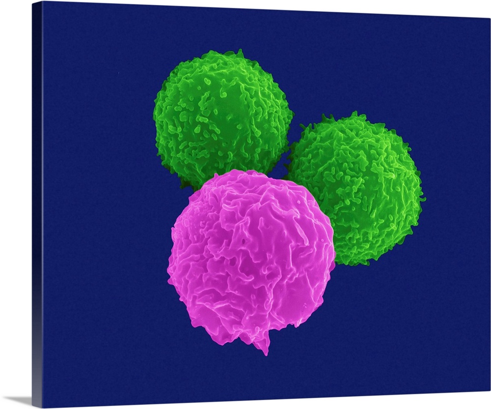 T lymphocytes (pre-T cells) and granulocyte (neutrophil), coloured scanning electron micrograph (SEM). Lymphocytes are inv...
