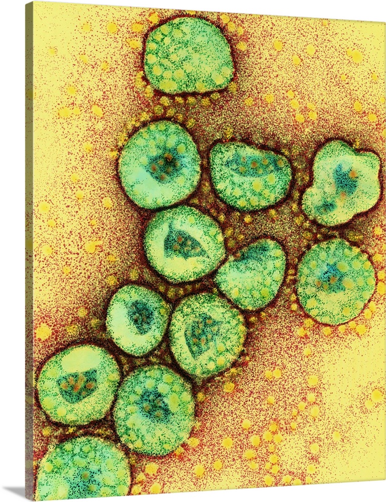 Corona viruses. Coloured transmission electron micrograph of a section through a cluster of corona viruses. The corona vir...