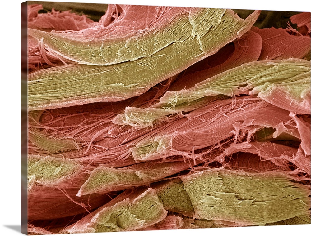 Tendon fibres. Coloured freeze-fracture scanning electron micrograph (SEM) of tendon fibres. These fibres are made from co...