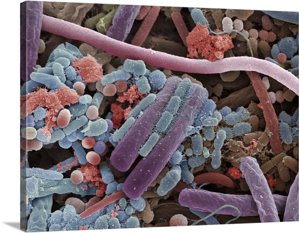 Tongue bacteria. Coloured scanning electron micrograph (SEM) of bacteria on the surface of a human tongue. Large numbers o...