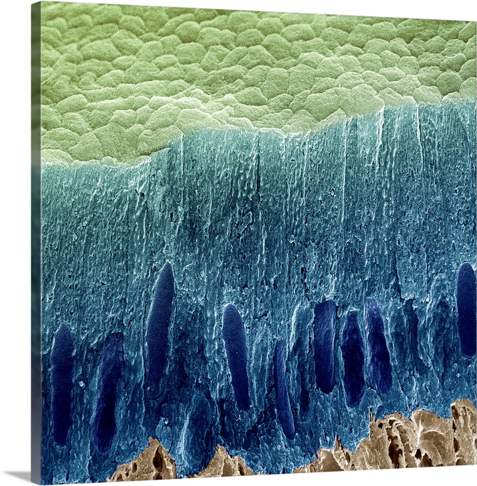 Tooth enamel formation. Coloured scanning electron micrograph (SEM) of a freeze-fractured section through a tooth, showing...