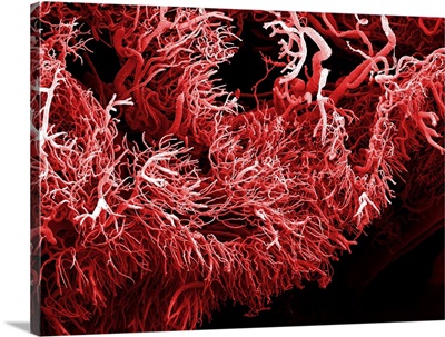 Tumour Blood Vessels, SEM