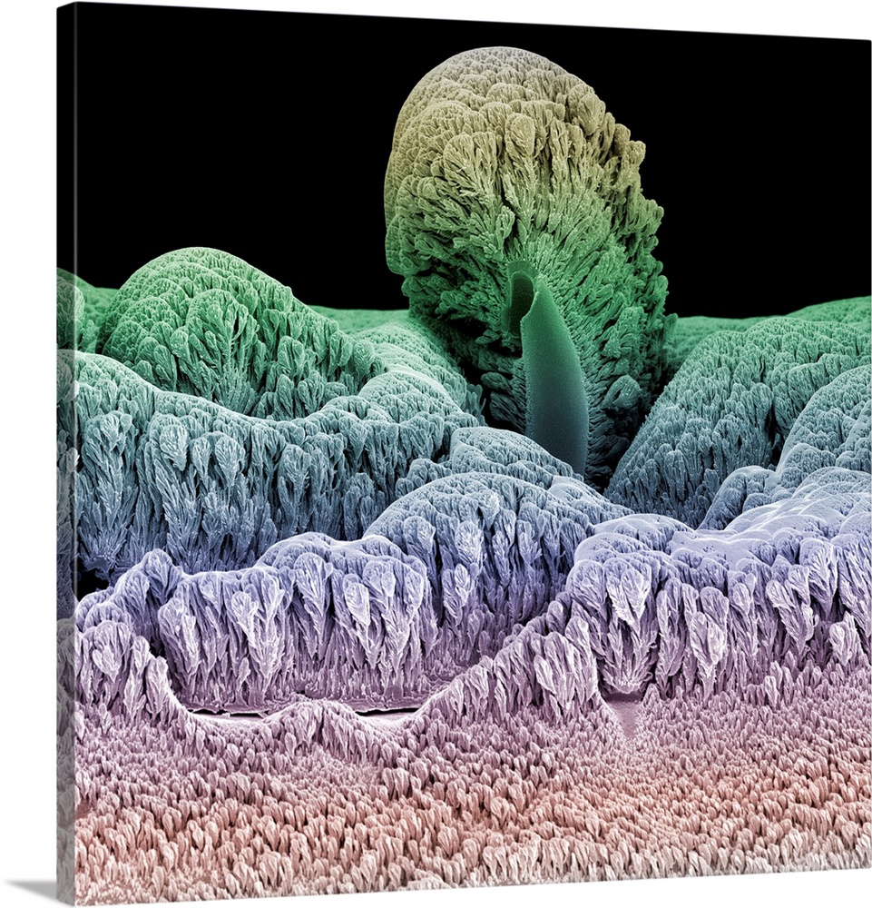 Tungsten. Coloured scanning electron micrograph (SEM) of crystals of tungsten metal, called a tungsten forest, coating the...