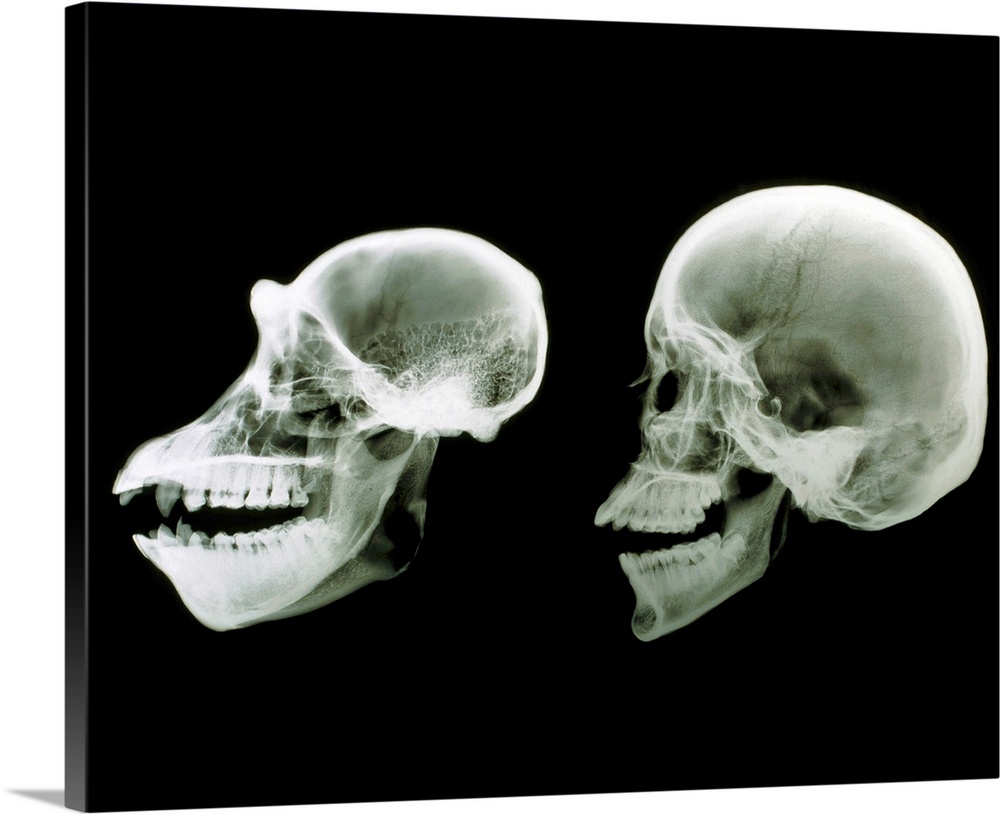 Primate skulls. X-ray of the skulls of a chimpanzee, Pan troglodytes, and human, Homo sapiens seen from the side. The chim...