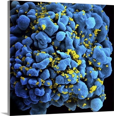 Colorized image of HIV-infected H9 T-cell