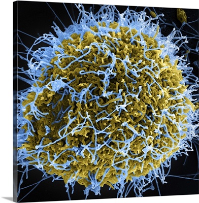 Colorized scanning electron micrograph of filamentous Ebola virus particles
