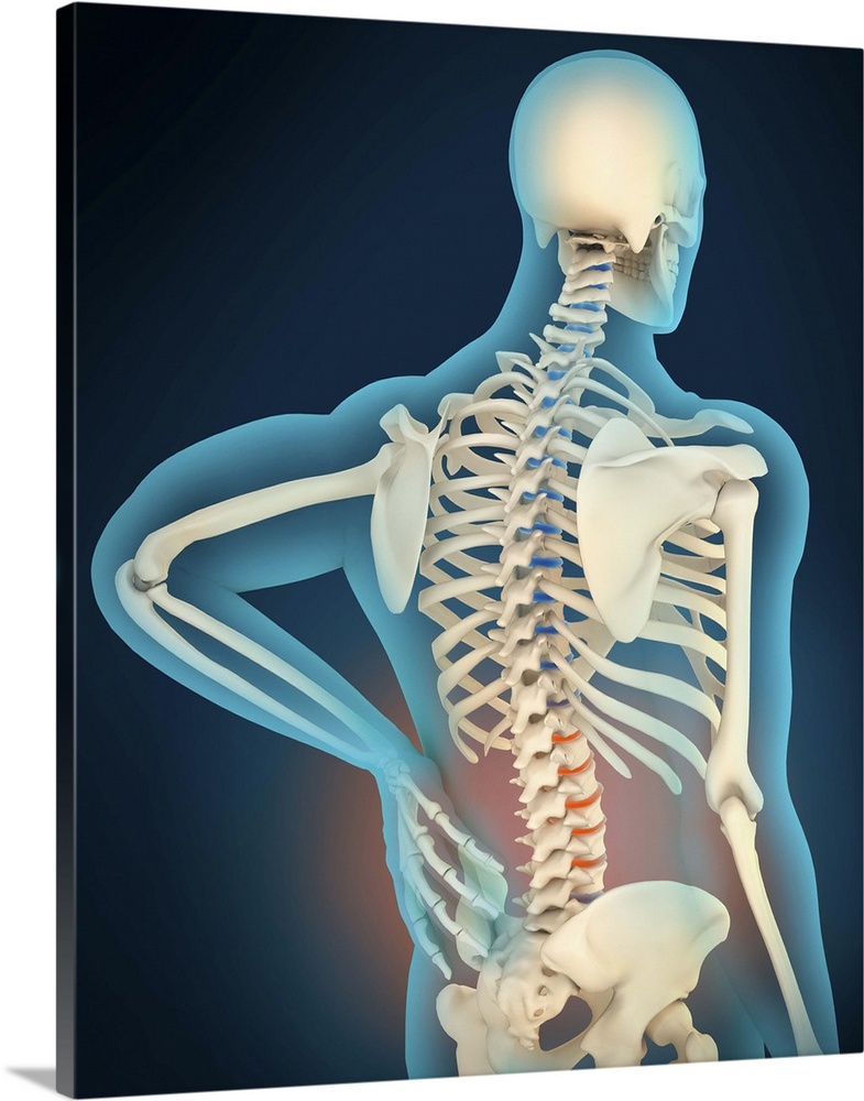 Medical illustration showing inflammation and pain in human back area, perspective view.