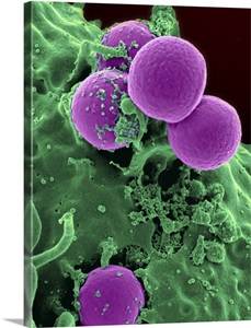 Scanning electron micrograph of a human neutrophil ingesting MRSA image thumbnail